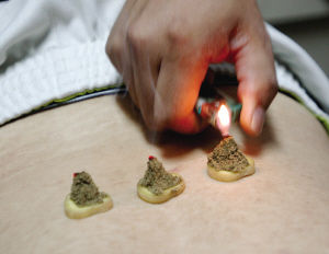 點擊將在新窗口查看全圖 艾灸養(yǎng)生術(shù)語