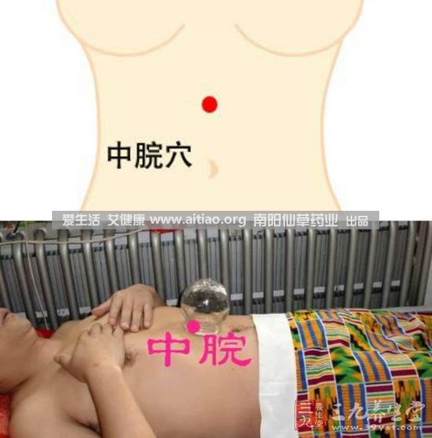 中脘穴位于腹部正中線，臍上4寸的位置上。每天艾灸10-15分鐘，能有效緩解胃部不適的癥狀，同時有助于祛濕。